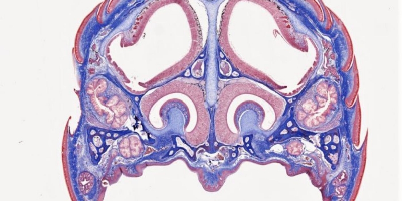 A cross section of a glass lizard brain.