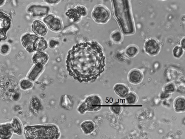 Microscopic view of particles